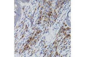 Immunohistochemistry of paraffin-embedded mouse lung using ASC/TMS1 Rabbit pAb (ABIN6131200, ABIN6146515, ABIN6146516 and ABIN6215212) at dilution of 1:150 (40x lens). (PYCARD Antikörper  (AA 50-195))