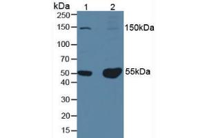 Western blot analysis of (1) Mouse Testis Tissue and (2) Mouse Brain Tissue. (PINP Antikörper)