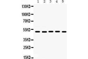Western Blotting (WB) image for anti-Lectin, Galactoside-Binding, Soluble, 8 (LGALS8) (AA 286-317), (C-Term) antibody (ABIN3043401) (LGALS8 Antikörper  (C-Term))