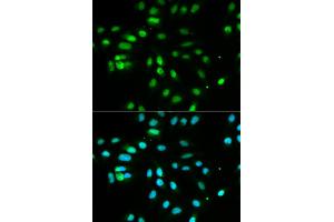 Immunofluorescence analysis of MCF-7 cells using PAX3 antibody (ABIN5970834). (Paired Box 3 Antikörper)