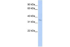 TNFRSF25 antibody (70R-10465) used at 0. (DR3/LARD Antikörper  (Middle Region))