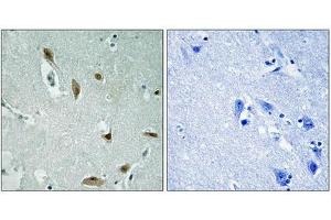 Immunohistochemistry analysis of paraffin-embedded human brain tissue using AKT1/3 (Phospho-Tyr437/434) antibody. (AKT1/3 (pTyr437) Antikörper)