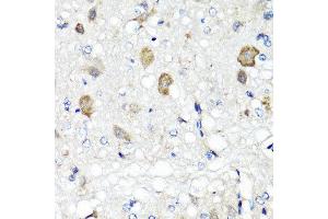 Immunohistochemistry of paraffin-embedded rat brain using RBP2 antibody at dilution of 1:100 (x40 lens). (RBP2 Antikörper)