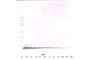 Image no. 2 for anti-Epidermal Growth Factor (EGF) antibody (ABIN465662) (EGF Antikörper)