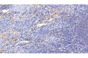 Detection of IL15 in Porcine Spleen Tissue using Polyclonal Antibody to Interleukin 15 (IL15) (IL-15 Antikörper  (AA 49-162))