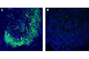 Expression of P2RY1 in rat spinal cord.