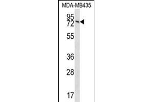 UNC84B Antibody (Center) (ABIN656370 and ABIN2845665) western blot analysis in MDA-M cell line lysates (35 μg/lane). (SUN2 Antikörper  (AA 237-265))