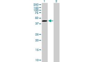 Western Blot analysis of TBC1D20 expression in transfected 293T cell line by TBC1D20 MaxPab polyclonal antibody. (TBC1D20 Antikörper  (AA 1-403))