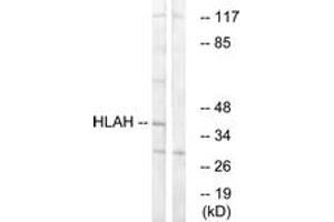 Western blot analysis of extracts from LOVO cells, using HLAH Antibody. (HLA-H Antikörper  (AA 71-120))