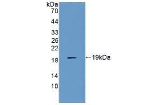 RAGE Antikörper  (AA 180-402)