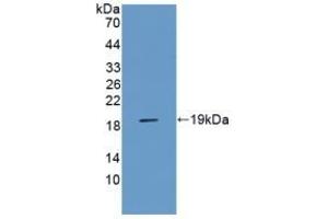 Detection of Recombinant AGER, Rat using Polyclonal Antibody to Receptor For Advanced Glycation Endproducts (RAGE) (RAGE Antikörper  (AA 180-402))