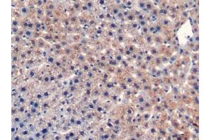 Detection of CD40L in Rat Liver Tissue using Monoclonal Antibody to Cluster Of Differentiation 40 Ligand (CD40L)