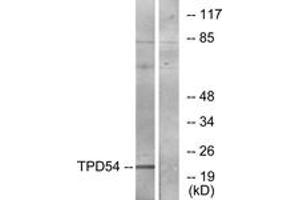 Western blot analysis of extracts from Jurkat cells, using TPD54 Antibody. (TPD52L2 Antikörper  (AA 141-190))