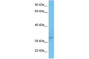 Host:  Rabbit  Target Name:  USF1  Sample Type:  Fetal Kidney lysates  Antibody Dilution:  1. (USF1 Antikörper  (N-Term))