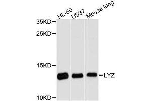 Western blot analysis of extracts of various cell lines, using LYZ antibody. (LYZ Antikörper  (AA 1-100))