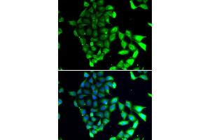 Immunofluorescence analysis of MCF7 cell using MID1 antibody. (MID1 Antikörper)