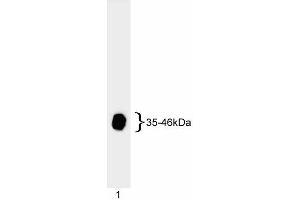 Western blot analysis of adenovirus E1A. (Human Adenovirus type 5 E1A (HAdV-5 E1A) Antikörper)