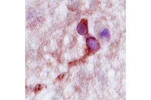 Human Hippocampus; CPLX2 antibody - N-terminal region in Human Hippocampus cells using Immunohistochemistry (CPLX2 Antikörper  (N-Term))