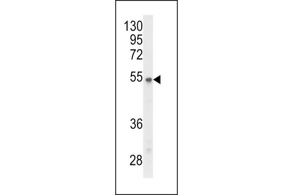 PPP2R3C Antikörper  (N-Term)