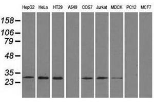 Image no. 6 for anti-Replication Protein A2, 32kDa (RPA2) antibody (ABIN1500736)