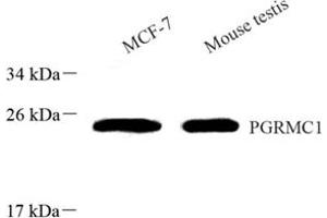 Western blot analysis of PGRMC1 (ABIN7075182) at dilution of 1: 800 (PGRMC1 Antikörper)