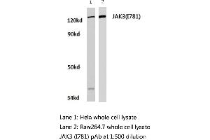 Western blot (WB) analysis of JAK3 antibody  in extracts from hela and raw264. (JAK3 Antikörper)