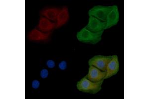 ABIN6258385 and ABIN6274982 staining Hela cells by IF/ICC. (CDC42EP5 Antikörper  (N-Term))