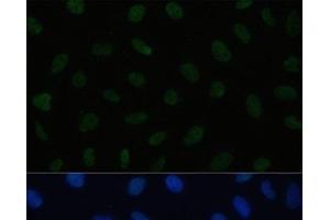 Immunofluorescence analysis of U2OS cells using HSF1 Polyclonal Antibody at dilution of 1:100. (HSF1 Antikörper)