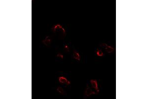 ABIN6262002 and ABIN6277764 staining HepG2 cells by ICC/IF.