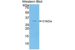 Western Blotting (WB) image for anti-PTEN Induced Putative Kinase 1 (PINK1) (AA 262-507) antibody (ABIN1860227)