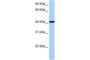 Western Blotting (WB) image for anti-Coiled-Coil and C2 Domain Containing 1B (CC2D1B) antibody (ABIN2463517) (CC2D1B Antikörper)