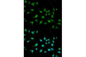 Immunofluorescence analysis of MCF7 cell using BMPR1B antibody. (BMPR1B Antikörper  (AA 1-126))