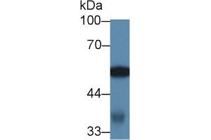 Western Blotting (WB) image for anti-4-Aminobutyrate Aminotransferase (ABAT) (AA 236-500) antibody (ABIN7445057)