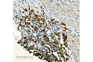 IHC analysis of CD20/MS4A1 using anti-CD20/MS4A1 antibody (ABIN7599233). (CD20 Antikörper  (AA 1-297))