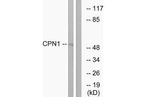 Western Blotting (WB) image for anti-Carboxypeptidase N Subunit 1 (CPN1) (C-Term) antibody (ABIN1851026) (CPN1 Antikörper  (C-Term))