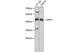 Western blot analysis of extracts of various cell lines, using DPEP1 antibody (ABIN6130950, ABIN6139781, ABIN6139782 and ABIN6221888) at 1:1000 dilution. (DPEP1 Antikörper  (AA 17-385))
