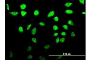 Immunofluorescence of monoclonal antibody to SFRS17A on HeLa cell. (SFRS17A Antikörper  (AA 53-156))