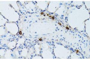 Immunohistochemistry of paraffin-embedded Rat lung using TEFM Polyclonal Antibody at dilution of 1:100 (40x lens). (TEFM Antikörper)