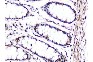Immunohistochemistry of paraffin-embedded human colon using JNK1/JNK3 Rabbit mAb (ABIN1678909, ABIN7101754, ABIN7101755 and ABIN7101756) at dilution of 1:100 (40x lens). (JNK Antikörper)