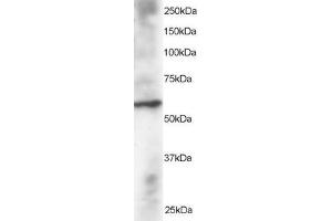 Western Blotting (WB) image for anti-Dual Specificity Phosphatase 8 (DUSP8) (N-Term) antibody (ABIN2465625) (DUSP8 Antikörper  (N-Term))