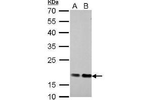 WB Image Cofilin 1 antibody detects CFL1 protein by Western blot analysis. (Cofilin Antikörper)