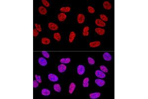 Confocal immunofluorescence analysis of U2OS cells using KHDRBS1/Sam68 Polyclonal Antibody (ABIN6133782, ABIN6142829, ABIN6142830 and ABIN6221707) at dilution of 1:400. (KHDRBS1 Antikörper  (C-Term))