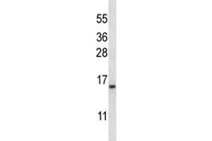 BAFF antibody western blot analysis in K562 lysate. (TNFRSF13C Antikörper  (AA 1-30))