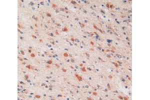 Immunohistochemistry (IHC) image for anti-Proteasome (Prosome, Macropain) 26S Subunit, ATPase, 6 (PSMC6) (AA 2-403) antibody (ABIN1860338)