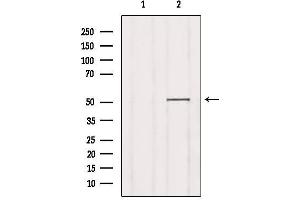 Western blot analysis of extracts from Mouse lung, using ZnT6 Antibody. (SLC30A6 Antikörper  (Internal Region))