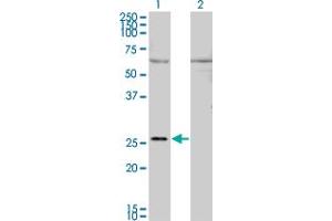 Western Blot analysis of GAP43 expression in transfected 293T cell line by GAP43 monoclonal antibody (M01), clone 3C11.