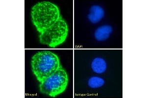 Immunofluorescence staining of fixed MCF7 cells with anti-Breast epithelial mucin antibody Mc5. (Rekombinanter MUC1 Antikörper)