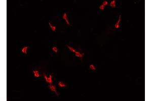 ABIN6266812 staining CACO-2 cells by IF/ICC. (ELF1 Antikörper  (C-Term))