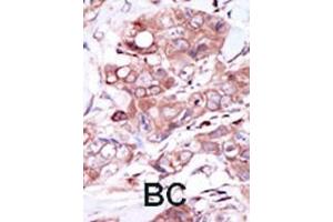 Immunohistochemistry (Paraffin-embedded Sections) (IHC (p)) image for anti-V-Erb-A erythroblastic Leukemia Viral Oncogene Homolog 4 (Avian) (ERBB4) (AA 1276-1308), (C-Term) antibody (ABIN391951)