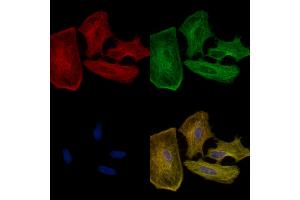 ABIN6258510 and ABIN6274721 staining  cells by IF/ICC. (MRPS35 Antikörper  (N-Term))